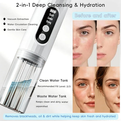 Electric Blackhead Remover | 6 Suction Heads Facial Pore Vacuum